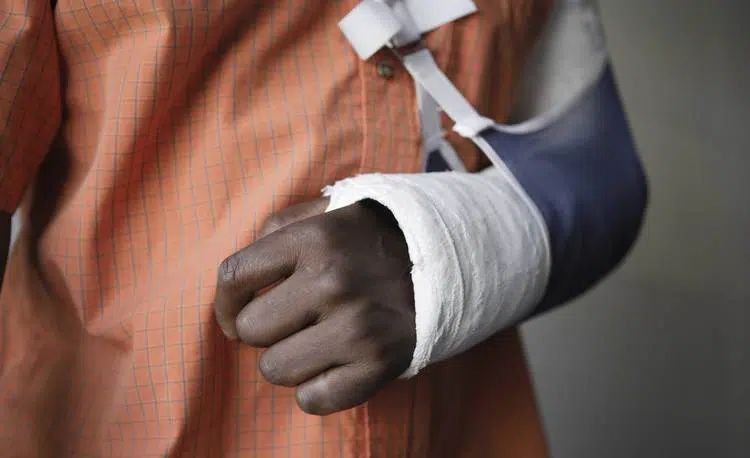 Injured person with arm in a cast and sling