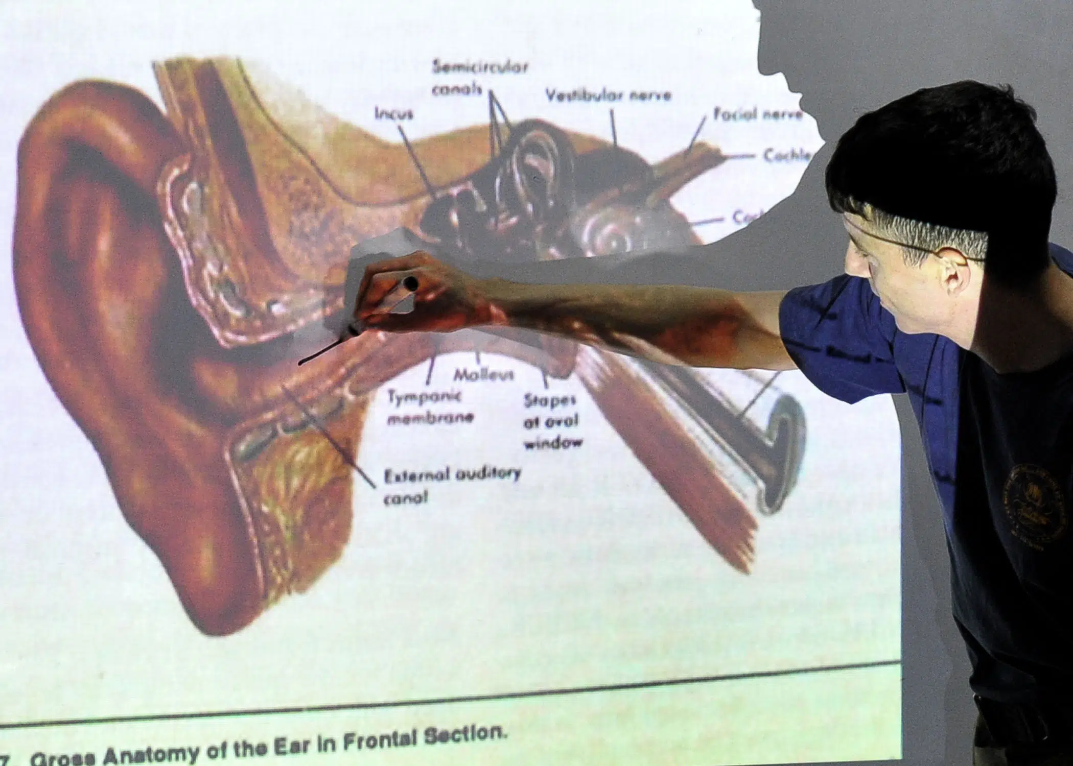 inner anatomy of ear and cause of tinnitus