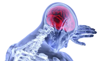 personal injury causing something mental