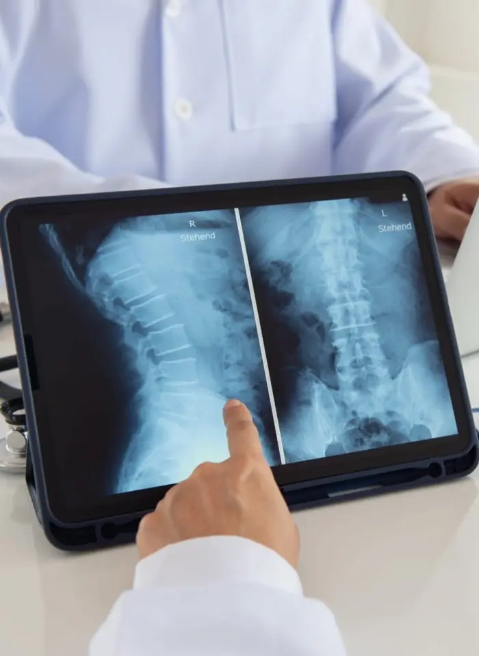 Spinal Injury
